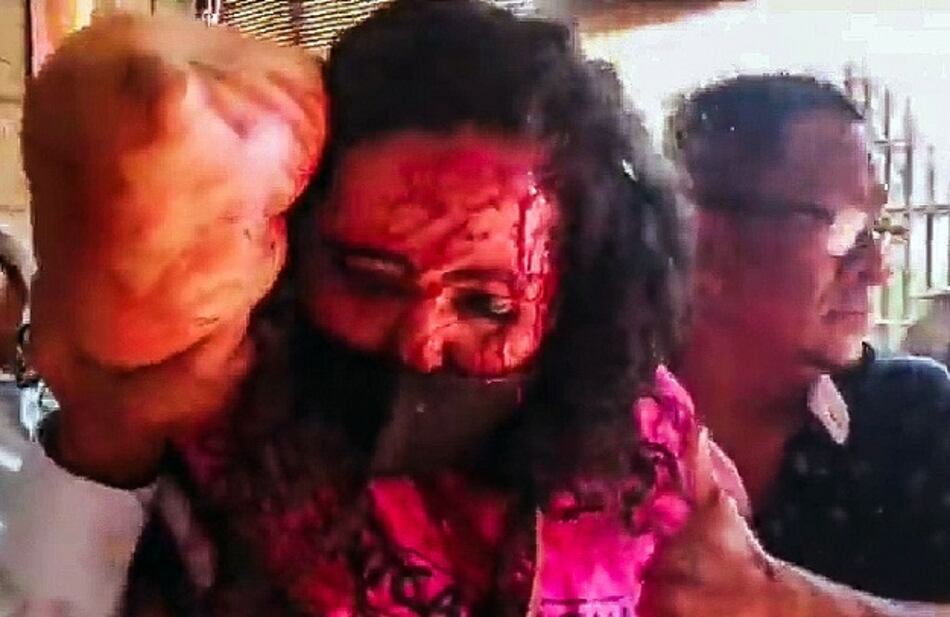 Hieren a periodista durante ataque de sandinistas a opositores en Nicaragua