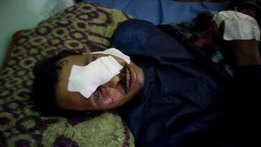 Suben a 305 los muertos por el ataque contra la mezquita en Egipto; 27 son niños