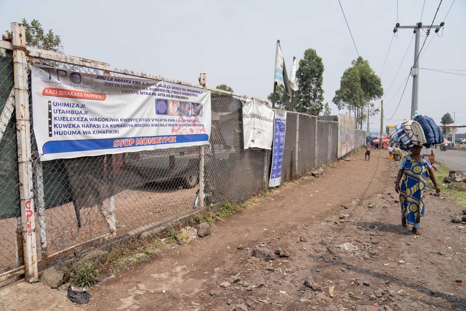 Registrados casi 19,000 casos de viruela símica y 540 muertes en 12 países de África en 2024