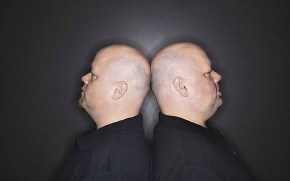 Estudio identifica nuevos genes vinculados con la calvicie