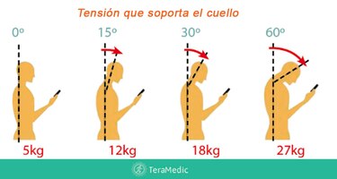 Tu teléfono podría estar dañando tu columna; descubre qué es el síndrome del cuello roto