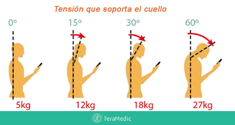 Tu teléfono podría estar dañando tu columna; descubre qué es el síndrome del cuello roto
