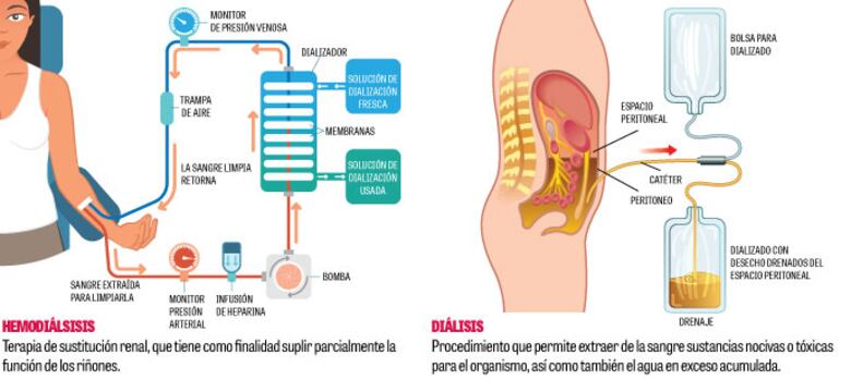 CSS negocia adenda para extender contrato de unidades de hemodiálisis