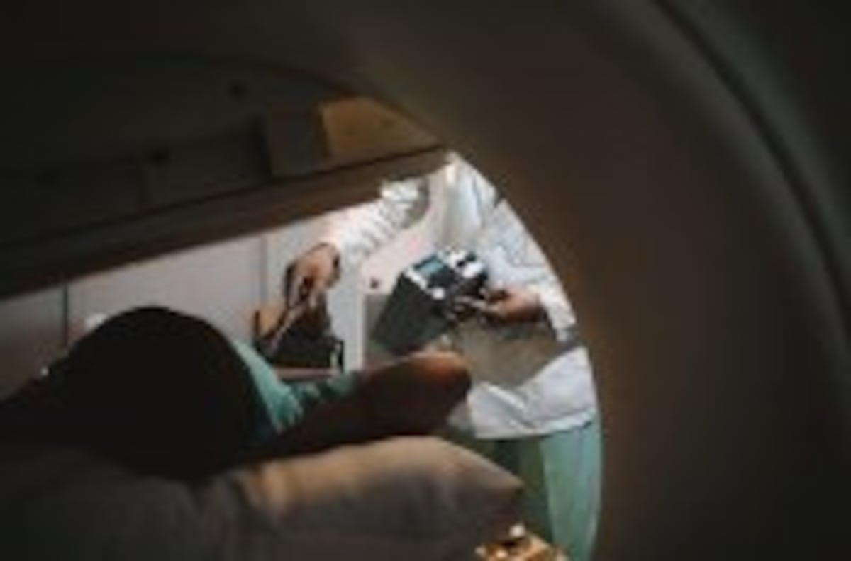El cáncer antes del diagnóstico
