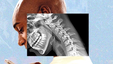 "Cuerpo de teléfono": cómo la tecnología nos arruga el cuello y debilita las manos