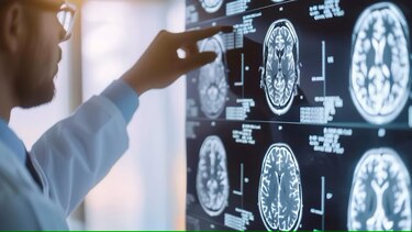 El Alzheimer no sabe que septiembre ha terminado