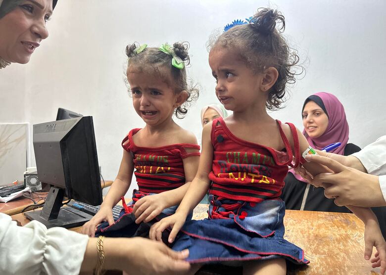 Médicos Sin Frontera alerta que 25% de niños y embarazadas de Gaza están desnutridos y responsabiliza a la ‘política del hambre’ israelí