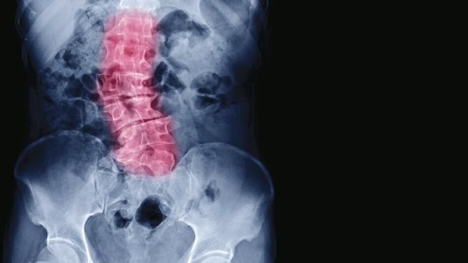 Busque el bienestar de sus huesos