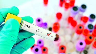 5 mitos del cáncer de próstata