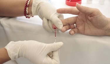 Casos de VIH se duplican en Chile, el mayor porcentaje de América Latina