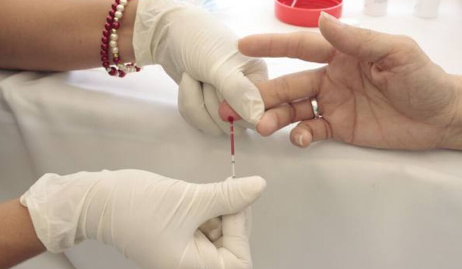 Casos de VIH se duplican en Chile, el mayor porcentaje de América Latina