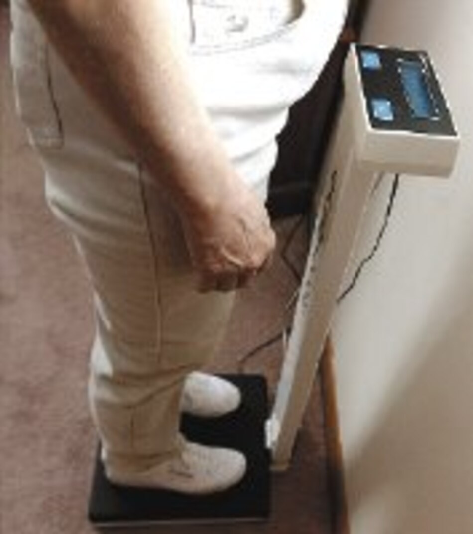 Malnutridos no son solo los muy flacos