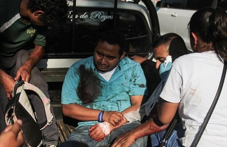 Heridos y detenidos durante protesta en Managua