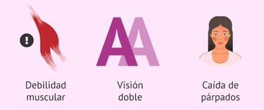 Navegando la miastenia gravis: diagnóstico, tratamiento y desafíos