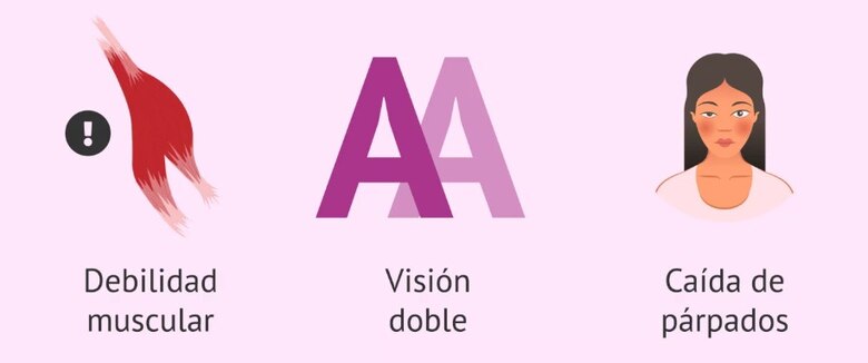 Navegando la miastenia gravis: diagnóstico, tratamiento y desafíos