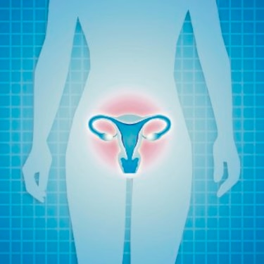 10 mitos acerca de la fibromatosis uterina