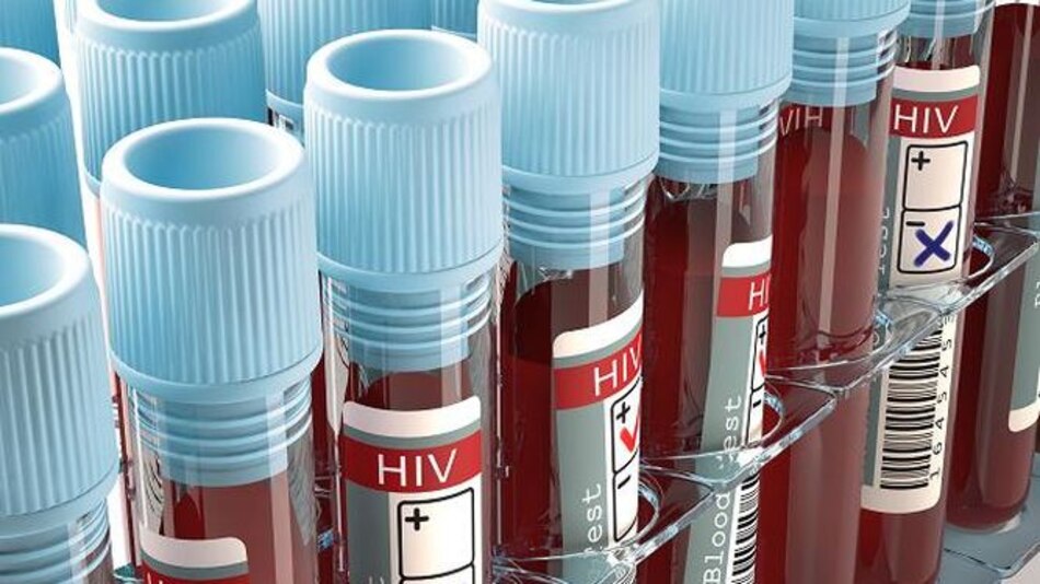 5 mitos sobre el VIH/sida (segunda parte)