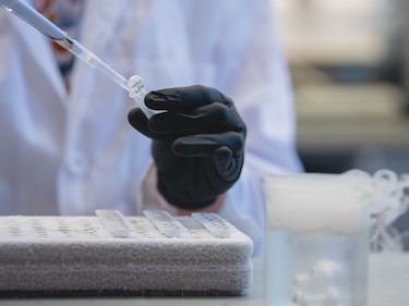 Un fármaco contra el cáncer podría ayudar a tratar el Alzheimer desde las primeras fases