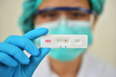 Se confirma el sexto caso exitoso de remisión del VIH tras un trasplante de médula ósea