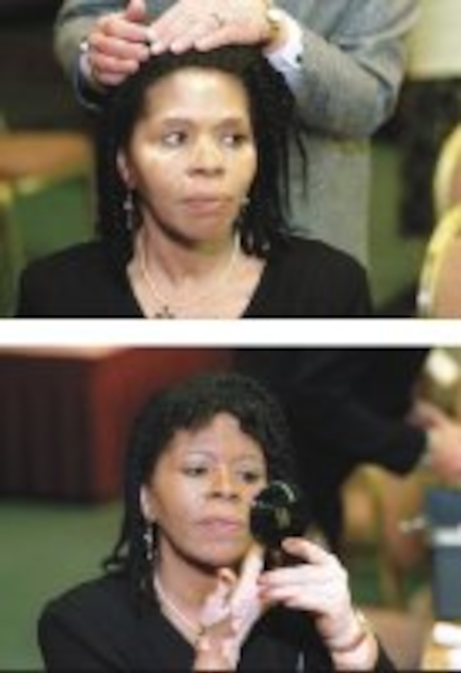 Estudios de la ‘lepra blanca’