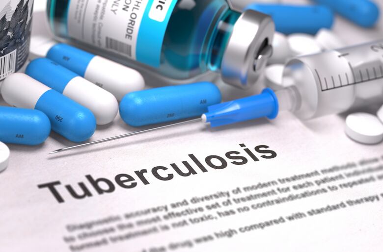 Tuberculosis: por un diagnóstico temprano
