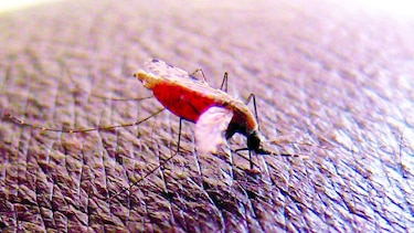 Potencial vacuna contra la malaria para niños