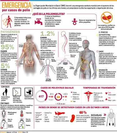 Alerta mundial por la polio
