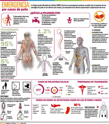 Alerta mundial por la polio