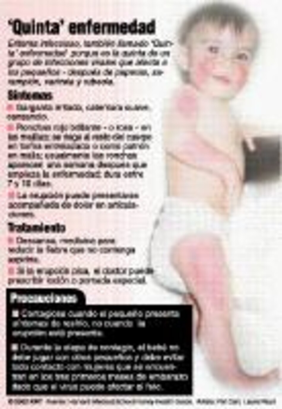 Salud Como una bofetada