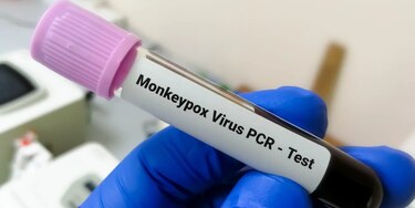 Panamá suma otra semana sin nuevos casos de viruela símica