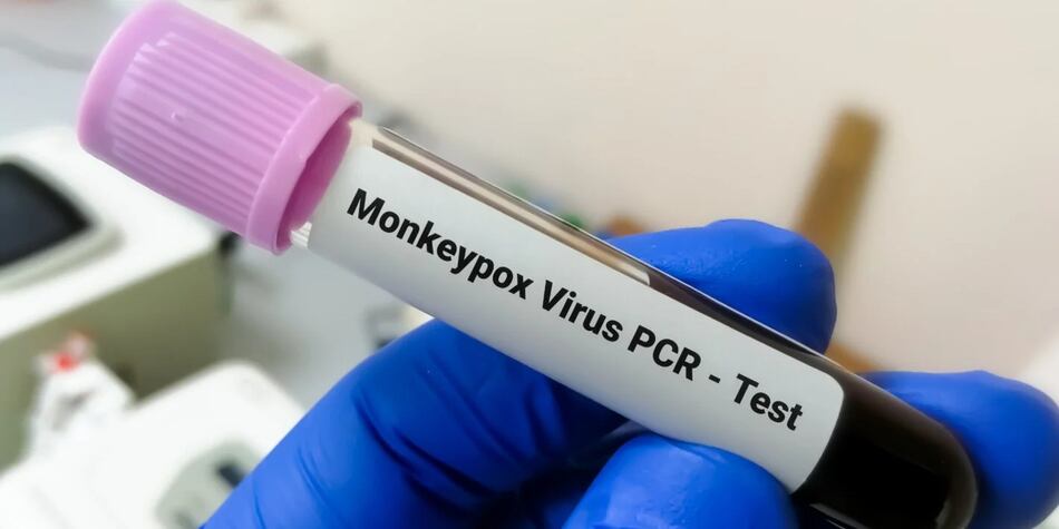 Panamá suma otra semana sin nuevos casos de viruela símica