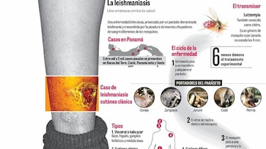 La leishmaniasis se acerca más a los centros urbanos