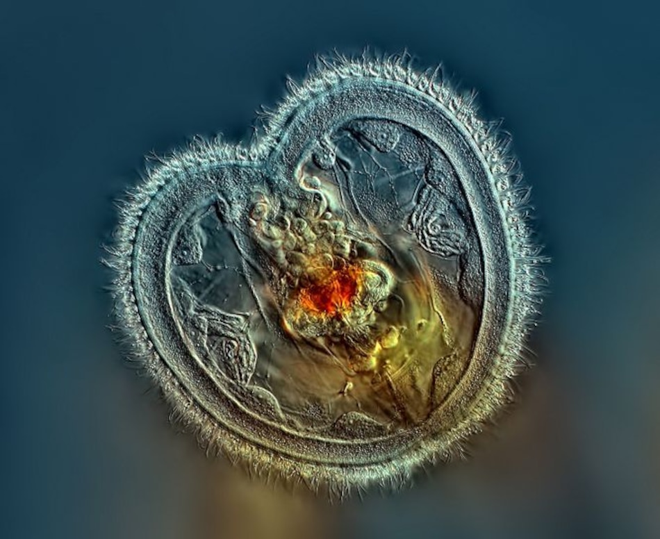 Panameño gana concurso internacional de fotografía a microorganismos