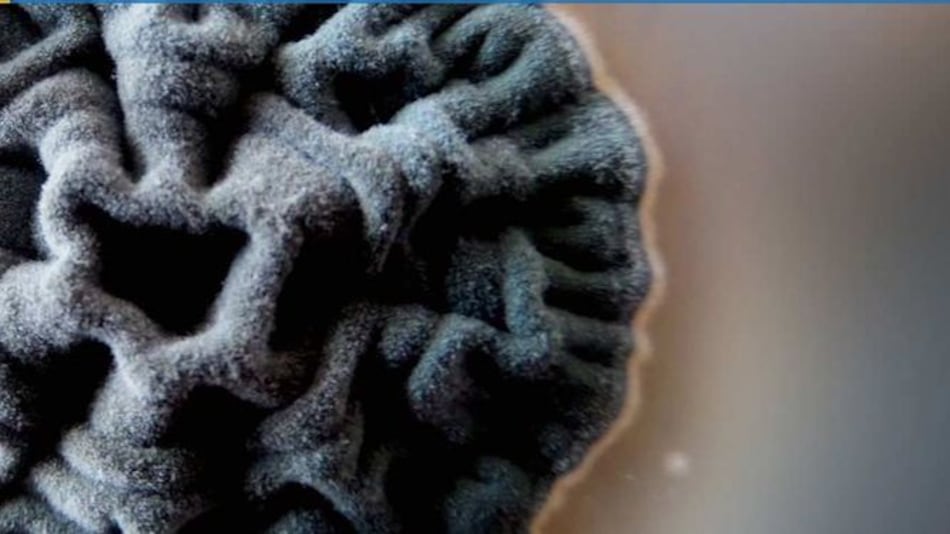 Salud, en riesgo por bacterias resistentes