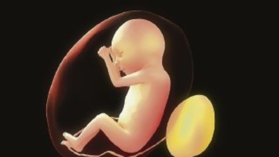 Alarman partos de bebés muertos