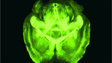 En los intrincados rincones del cerebro