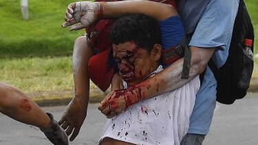 ‘Preocupante’ aumento de muertos por escalada represiva en Nicaragua