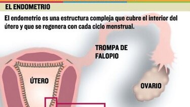 Endometrio, factor de la fertilidad