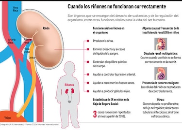 La insuficiencia renal infantil pasa de 5 casos nuevos por año a 3 por mes