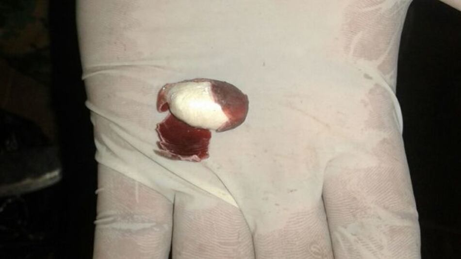 Decomisan 7 mil cápsulas con cocaína envueltas en cáscaras de frijoles