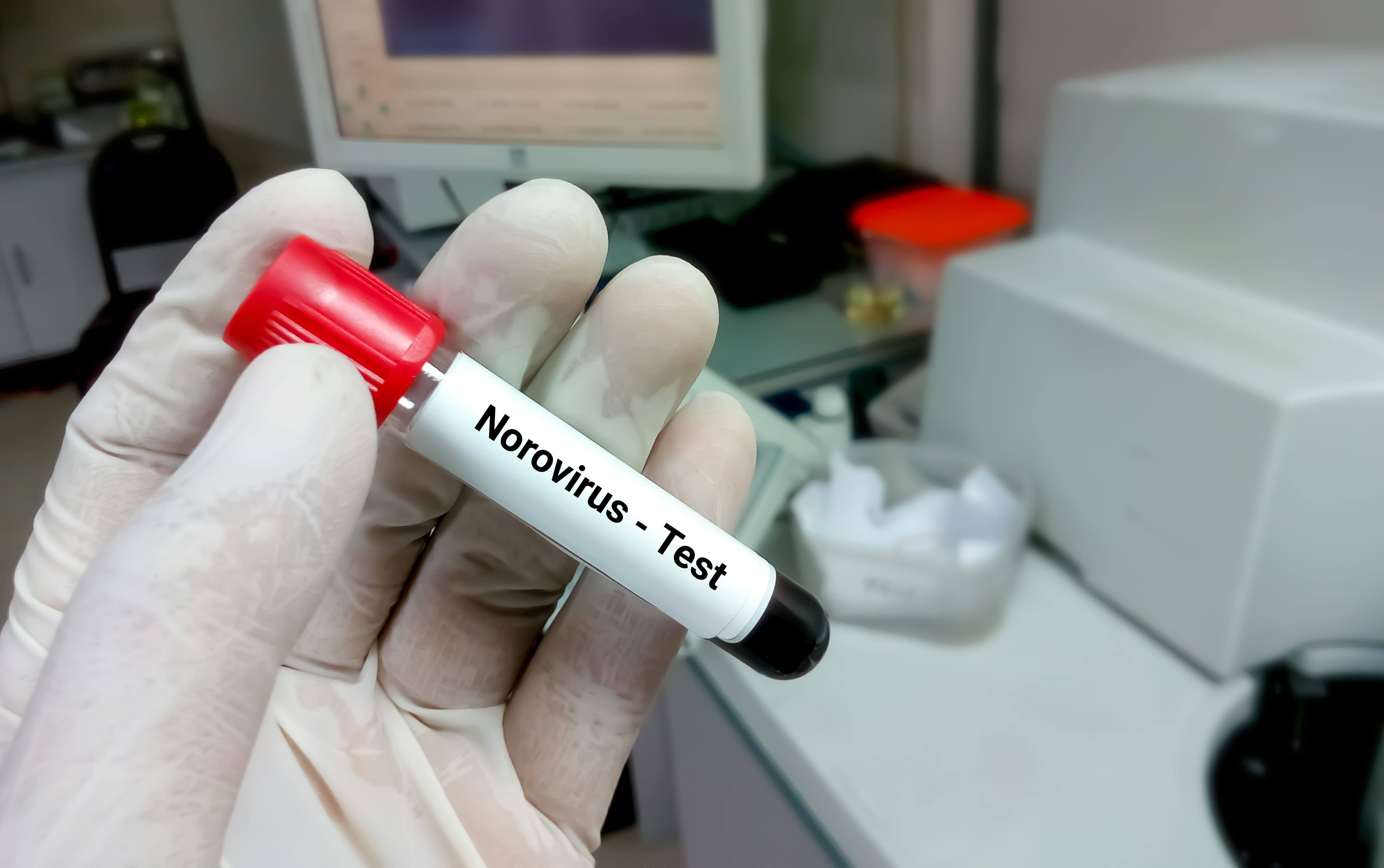 Minsa confirma norovirus como causa de brote gastrointestinal en Chiriquí