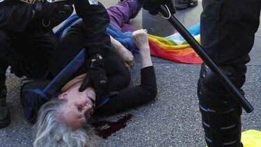 Francia investiga las heridas que sufrió una anciana en una protesta