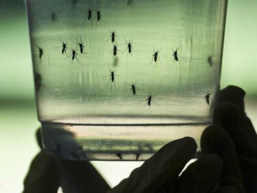 Aumentan casos de microcefalia en Brasil: vínculo con zika