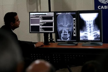 Servicio de Radiología fue suspendido en el Minsa por ‘decisión unilateral de la empresa’