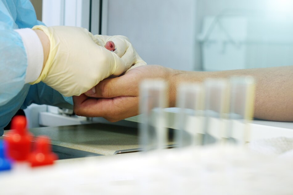 Trabajo de prevención del VIH, a medias por falta de refrendo de la Contraloría a contratos