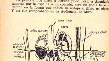 Lipstein tiró contra Remón