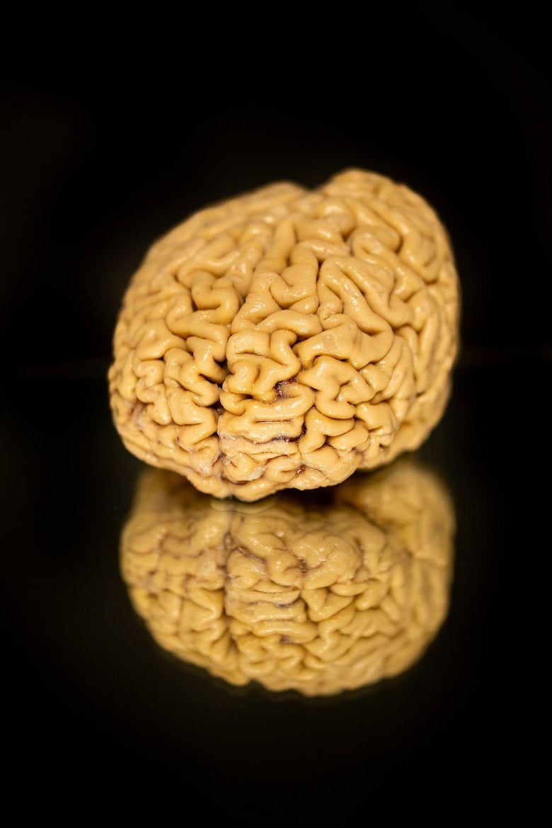 Cómo son los cerebros de los ‘superancianos’