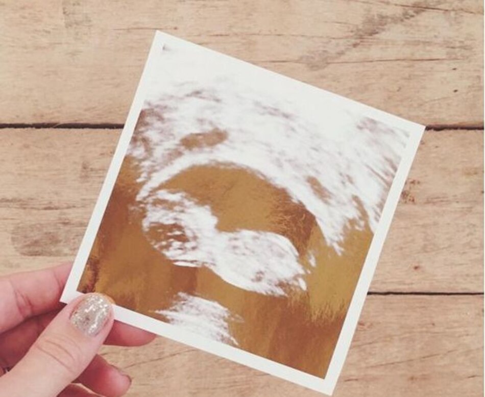 Lauren Conrad , estrella de 'The Hills', anuncia que está embarazada