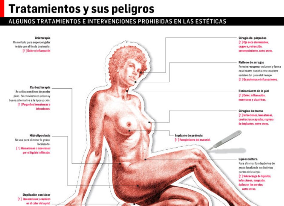 Riesgos en métodos de belleza