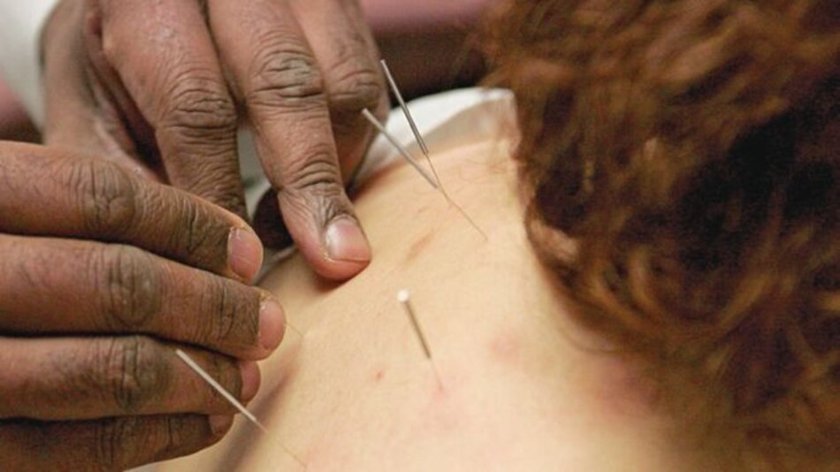 Guerra contra la acupuntura, homeopatía y otras ‘pseudoterapias’ médicas